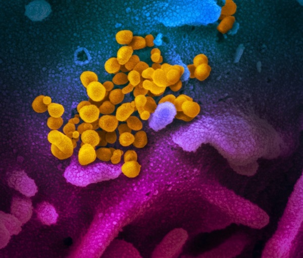 Phát hiện mới về virus corona, mở cơ hội cho vắcxin duy nhất-1