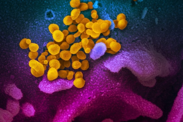 Những loại virus nguy hiểm nhất trên trái đất-3