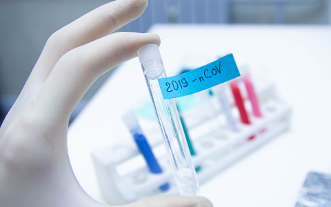 PGS Trần Đắc Phu: Mở rộng xét nghiệm cộng đồng sẽ vỡ trận như khẩu trang y tế-1