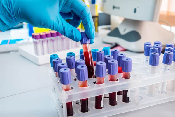 Người dùng nhận được thông điệp Stay Home trên điện thoại iPhone-6