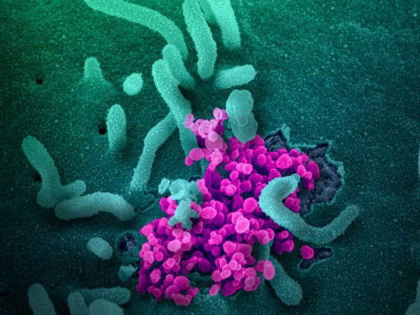 Tin vui: Virus corona đột biến chậm hơn cúm, vắc-xin Covid-19 sẽ có hiệu quả kéo dài-3