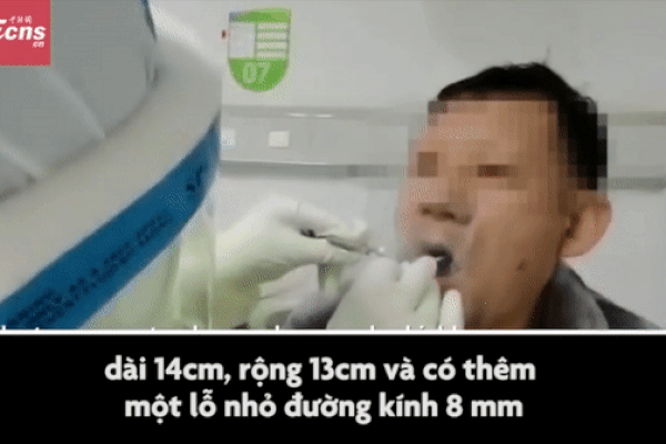 Phát minh tấm chắn làm giảm nguy cơ lây nhiễm SARS-CoV-2 cho bác sĩ