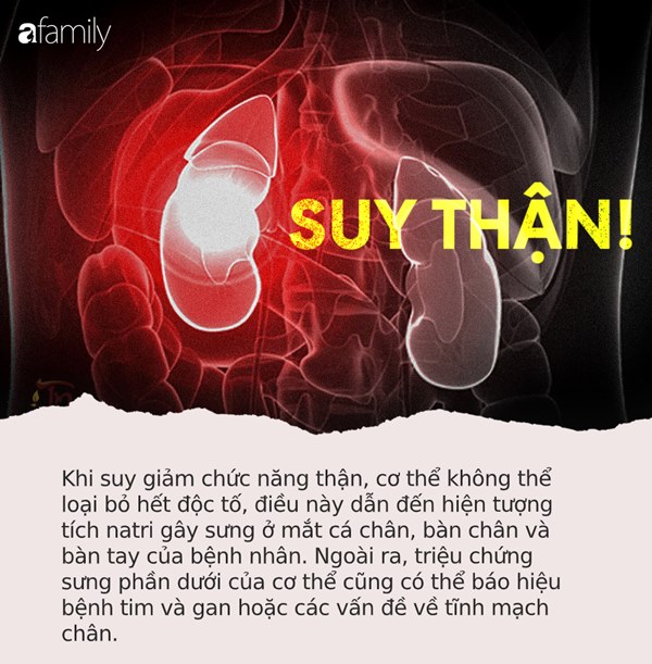 Con trai 12 tuổi đã mắc ung thư thận, bố mẹ ân hận khi biết nguyên nhân đến từ loại thực phẩm quen thuộc mà bé ăn quá nhiều-3