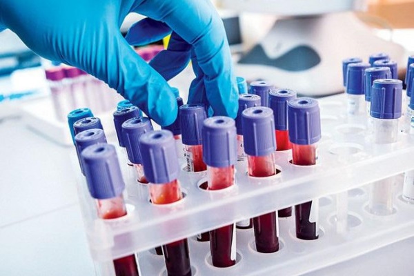 Đột phá: phương pháp đơn giản phát hiện 50 loại ung thư trước khi bệnh-1