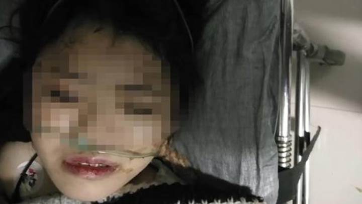 Thiếu nữ 15 tuổi bị tra tấn dã man và phải nhảy từ tầng 5 để thoát thân, dư luận phẫn nộ khi biết được danh tính, tuổi tác của những kẻ phạm tội-2