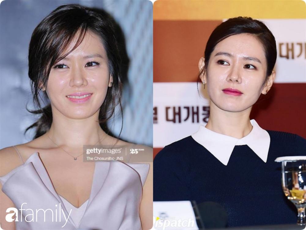 Nhan sắc hoàn hảo như chị đẹp Son Ye Jin cũng có lúc bị dìm không thương tiếc chỉ vì kiểu tóc rối bời hay màu son hồng cánh sen-5