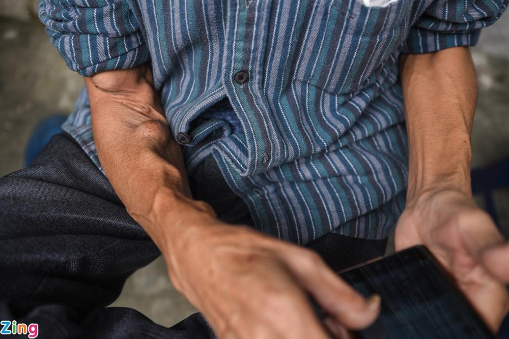 Xóm chạy thận Bạch Mai giữa dịch Covid-19-3