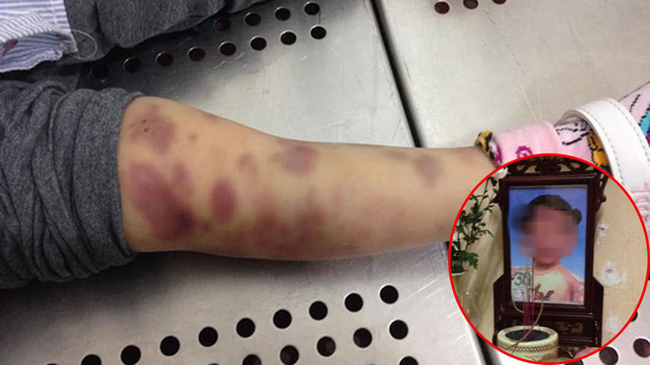 Thông tin mới vụ án bé gái 3 tuổi tử vong nghi bị mẹ và cha dượng bạo hành-2