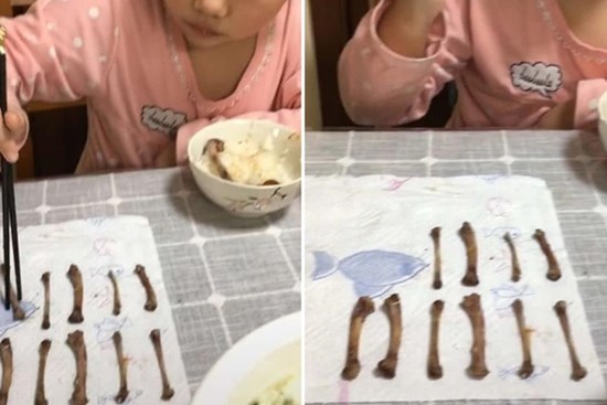 Bà mẹ đăng ảnh con gái trong bữa ăn để khoe con ngăn nắp nhưng người xem lại giục cô nhanh chóng đưa con đi khám bác sĩ