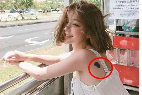 Ý nghĩa theo nhân tướng học của các vết bớt: Bớt ở chân xui xẻo đủ đường