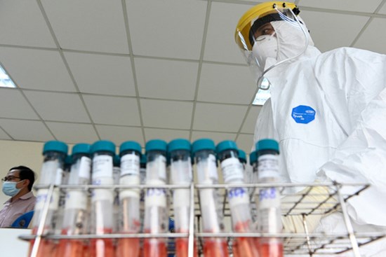 Làm xét nghiệm dịch vụ phát hiện SARS-CoV-2 ở đâu? Mức phí bao nhiêu?