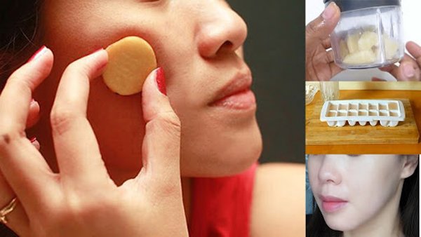 Sống chung với nám bao năm là vì bạn chưa biết đến 5 loại mặt nạ trị nám này thôi-3