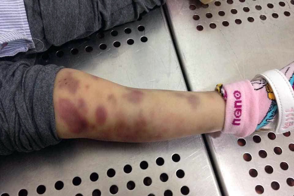 Mẹ đẻ, cha dượng bạo hành bé gái 3 tuổi đáng chịu mức án cao nhất-2