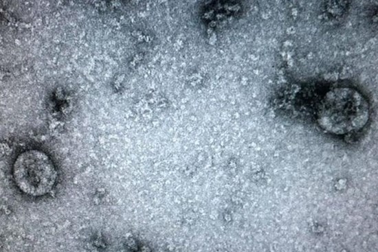 'Virus gây bệnh Covid-19 ở Việt Nam đã tiến hóa'