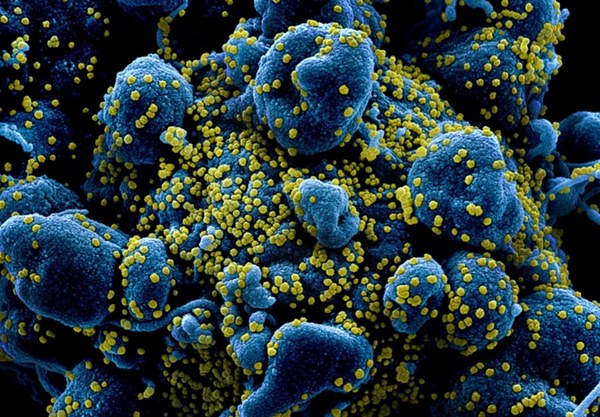 Tìm ra điểm yếu của virus corona-2