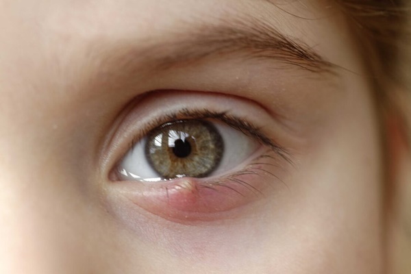 Nếu cơ thể có 4 dấu hiệu nhỏ này trên môi, mặt, tay, chân thì bạn cần kiểm tra sức khỏe ngay-5