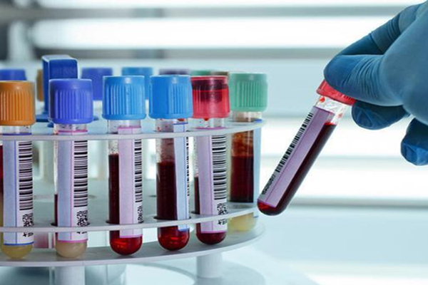 Bị triệu tập vì nghi ăn trộm, nam thanh niên dọa vừa từ Bạch Mai về để trốn công an-2