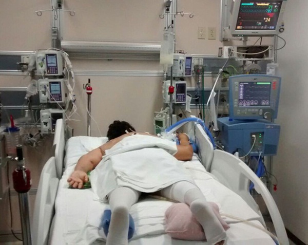 Trải nghiệm vượt cửa tử của những bệnh nhân Covid-19 trong phòng chăm sóc tích cực: Cảm giác giống như... bị chôn sống-3