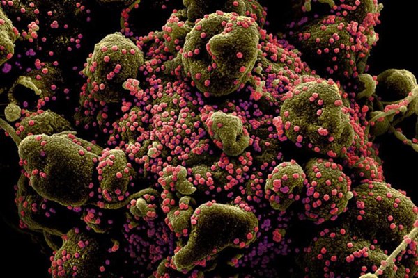 Virus corona: Cộng sinh với dơi ít nhất hơn 10.000 năm và lí do cần sinh vật trung gian để lây sang người-2