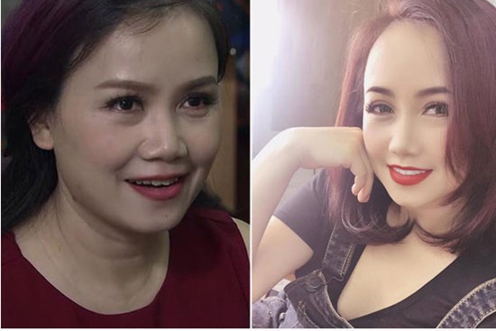 'Cô Xuyến' Hoàng Yến nói gì khi bị nghi 'đại phẫu' khuôn mặt?
