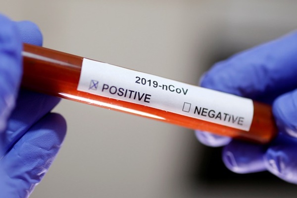 Quá trình điều trị cho bệnh nhân ung thư nhiễm Covid-19-1