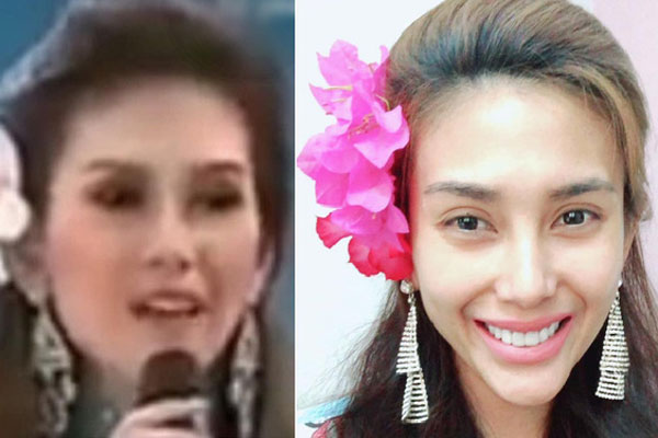 Xót xa nụ cười lạc quan cùng hình ảnh sắc vóc đỉnh cao của Hoa hậu Colombia bị cưa chân trái vì biến chứng phẫu thuật-14