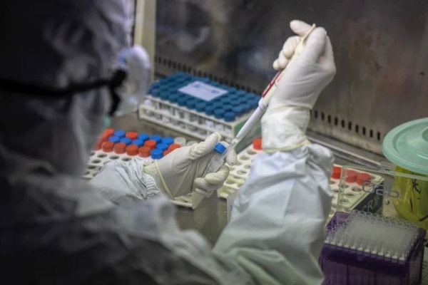 Mỹ áp dụng thử nước bọt để phát hiện virus SARS-CoV-2-2