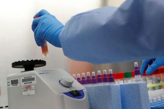Mỹ áp dụng thử nước bọt để phát hiện virus SARS-CoV-2