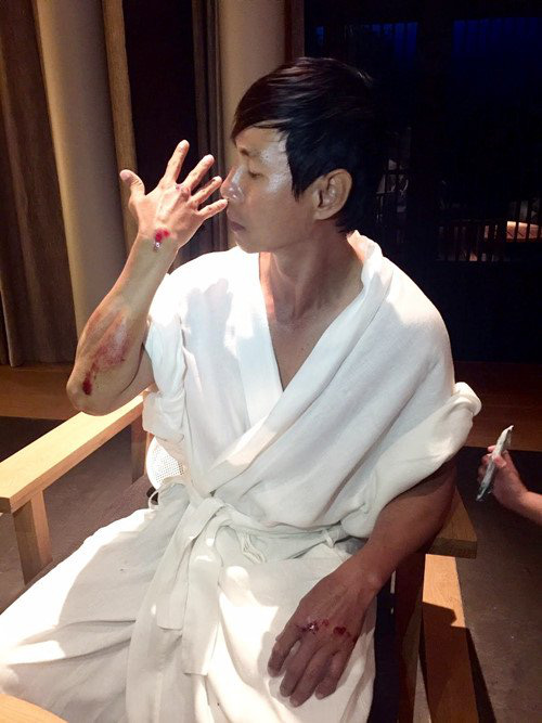 Sao Việt đau đớn do tai nạn hi hữu ở hậu trường: Trúc Anh bị xe lôi xềnh xệch, Lý Hải - Trương Ngọc Ánh đổ máu vì vai diễn-4