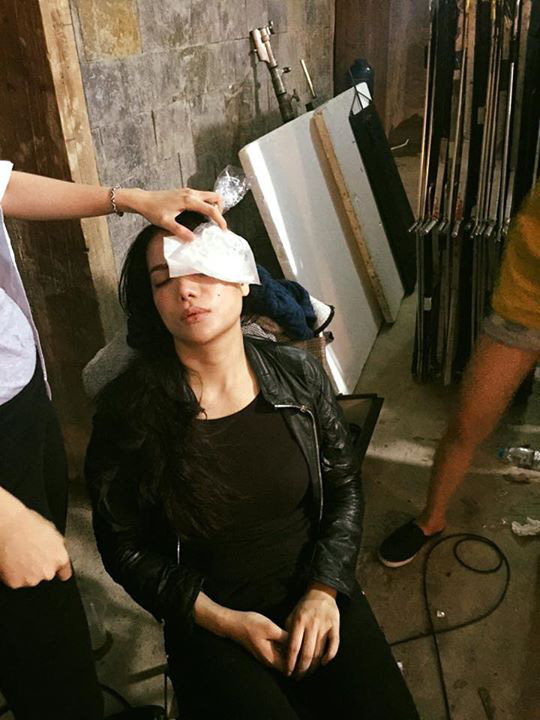 Sao Việt đau đớn do tai nạn hi hữu ở hậu trường: Trúc Anh bị xe lôi xềnh xệch, Lý Hải - Trương Ngọc Ánh đổ máu vì vai diễn-7