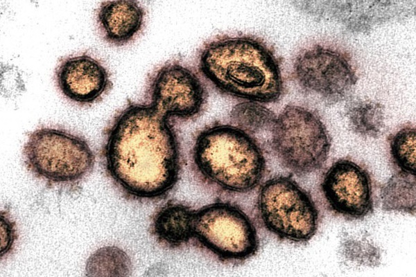 Biến chủng SARS-CoV-2 ở Ấn Độ đe dọa nỗ lực điều chế vaccine-1