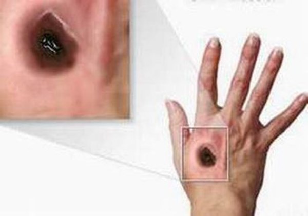 Vũ khí cực mạnh của dơi khiến virus tắt điện nhưng vô tình gây hại cho hệ miễn dịch người!-1