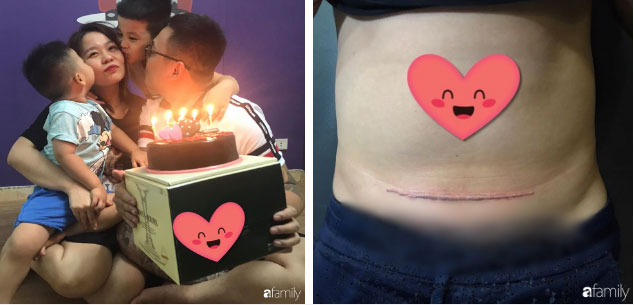 Thương vợ mang nặng đẻ đau 2 lần, ông bố trẻ Hà Nội âm thầm đi xăm vết sẹo mổ y hệt vợ để động viên bà xã-4