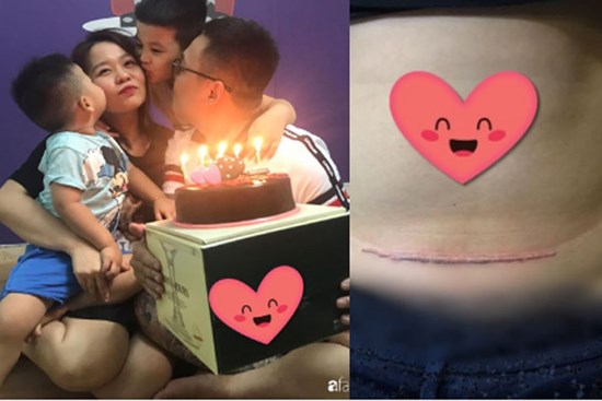 Thương vợ mang nặng đẻ đau 2 lần, ông bố trẻ Hà Nội âm thầm đi xăm vết sẹo mổ y hệt vợ để động viên bà xã