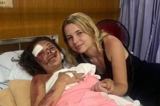 Chuyến chu du khắp thế giới bỗng hóa thảm kịch chỉ vì chiếc xe máy, gương mặt nữ giáo viên bị hủy hoại khiến người thân không thể nhận ra