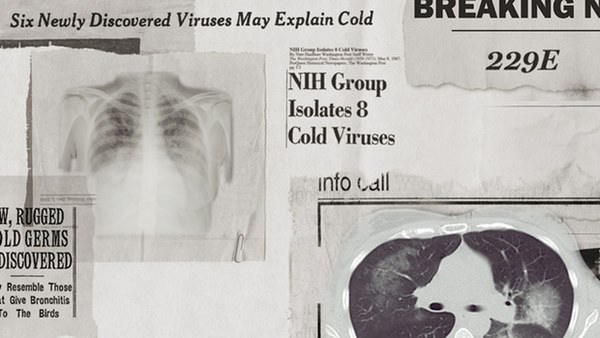 Lịch sử bí ẩn của họ virus corona: Từ cơn cảm lạnh thông thường đến những đại dịch toàn cầu-1