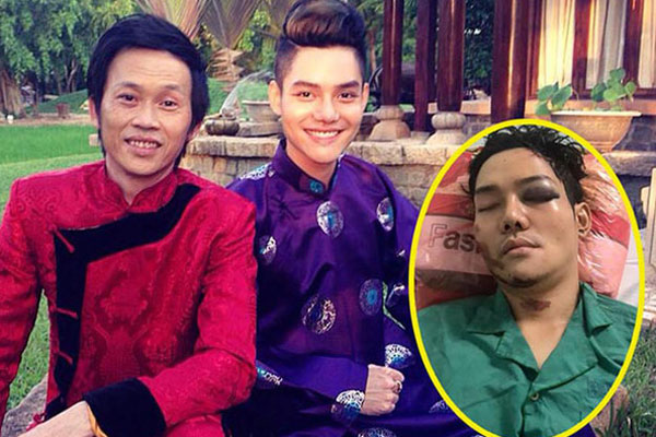 Ca sĩ Bùi Duy Ngọc chấn thương não, liệt nửa mặt vì tai nạn-3