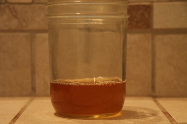 Chỉ cần dựa vào 3 dấu hiệu siêu nhỏ này khi đi tiểu, chị em hoàn toàn có thể phát hiện sớm căn bệnh ung thư bàng quang nguy hiểm-2