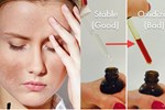 Bác sĩ da liễu khẳng định đây là 4 sản phẩm giúp bạn đẩy lùi vết thâm nám để da đẹp căng không tỳ vết-5