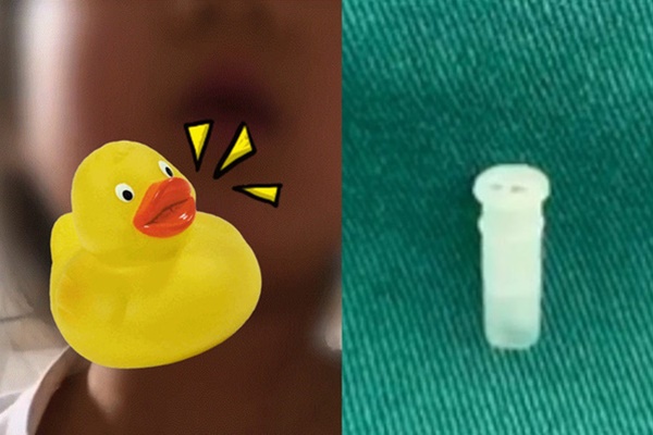 Em bé đáng thương nuốt nhầm cái còi, hễ hít thở là kêu chíp chíp-1