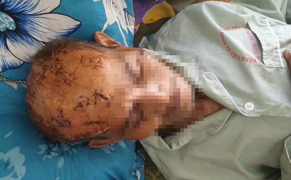 Người con trai nghi rạch nát đầu cha 74 tuổi để giành đất liệu sẽ đối diện án phạt nào?-1