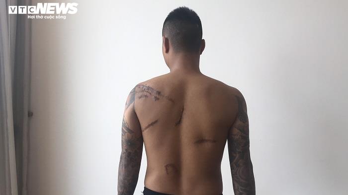 Nghi vấn đàn em Đường Dương truy sát nam thanh niên lúc nửa đêm rồi vứt xuống hố-1