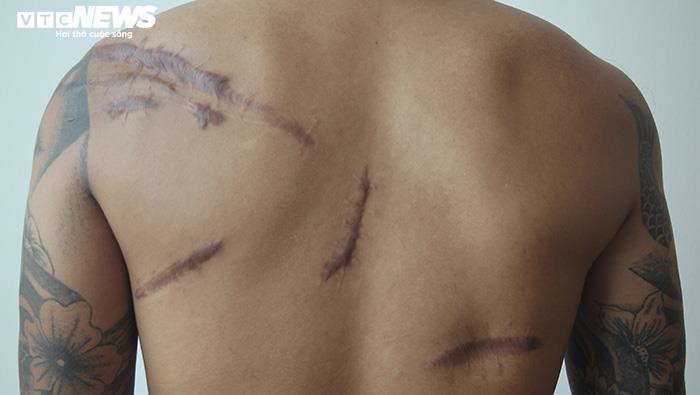 Nghi vấn đàn em Đường Dương truy sát nam thanh niên lúc nửa đêm rồi vứt xuống hố-3