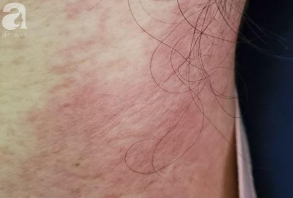 Cảnh báo dùng rượu gừng nghệ hạ thổ làm đẹp cho phụ nữ sau sinh-1