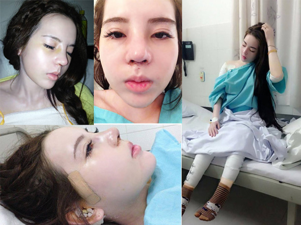 Mẹ Việt 2 con chi gần 1 tỷ đồng cho 8 cuộc phẫu thuật nâng cấp dung mạo, được trang báo Hàn đình đám Dispatch đưa lên trang nhất và gọi là nữ thần-8