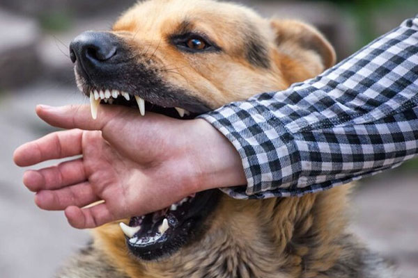 Chó becgie 38kg tuột xích tấn công bé trai 2 tuổi nhập viện-2