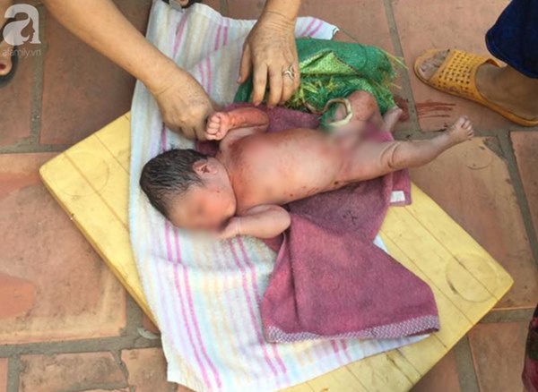 Tây Ninh: Thương tâm bé gái bị bỏ rơi trong bao đựng gạo ở nghĩa địa, kiến cắn sưng đỏ người-1