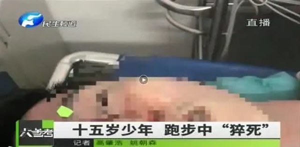 Trung Quốc: Nam sinh 15 tuổi đột tử khi đeo khẩu trang trong lúc tập thể dục, chuyên gia y tế lý giải điều này như thế nào?-1