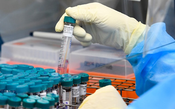 Bệnh nhân Covid-19 tái dương tính tại Việt Nam được điều trị thế nào?-1