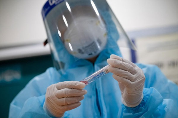 Bệnh nhân 91 rất nặng, hôm nay được hội chẩn ghép phổi-2